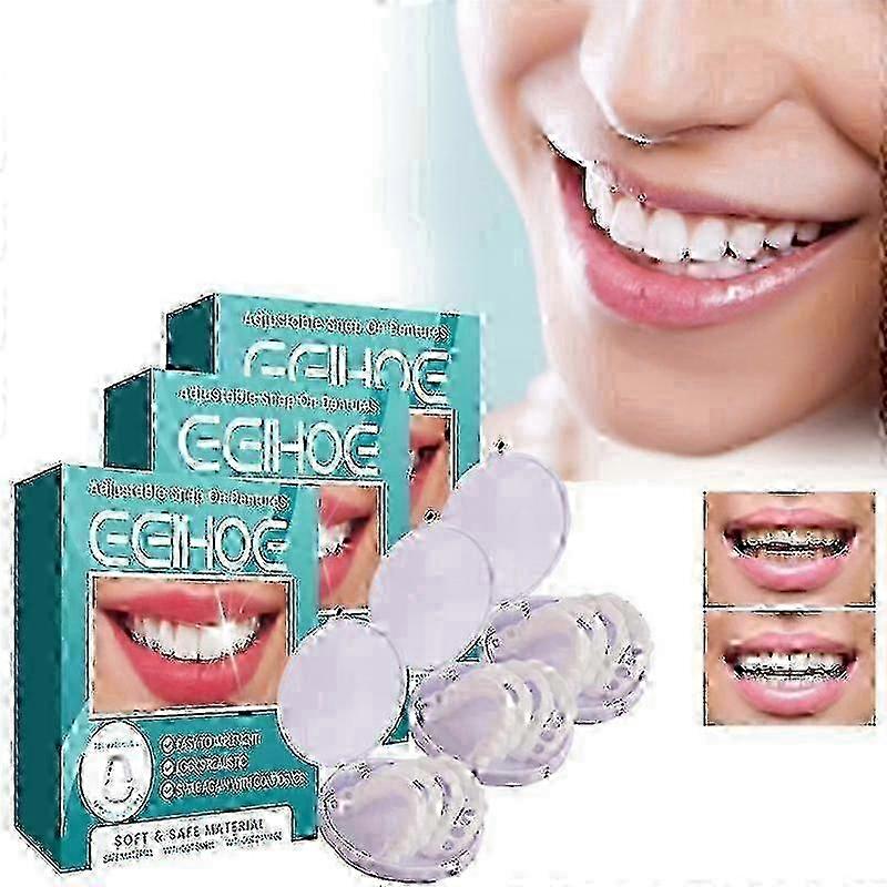 Adjustable Snap-on Dentures, Veneers & Braces Kit with Cases, Temporary Fillings & Straightening Tools