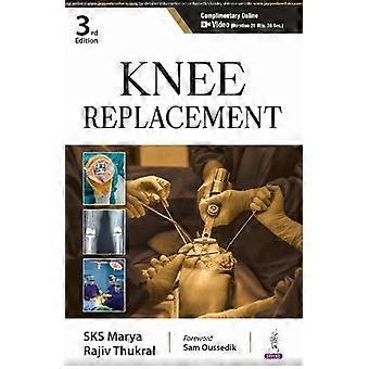 Knee Replacement - SKS Marya