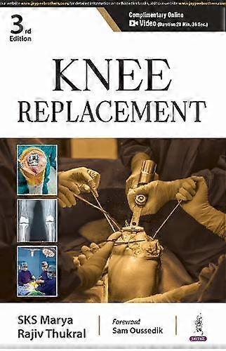 Knee Replacement - SKS Marya
