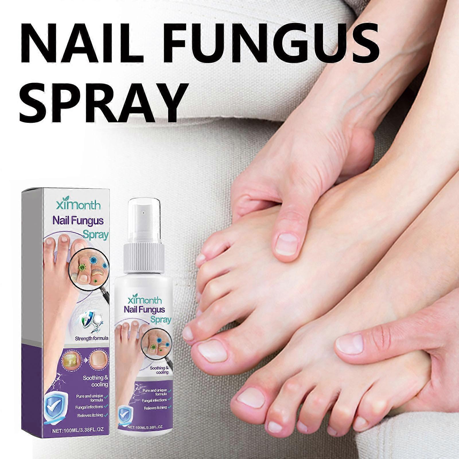 Nail Spray Fresh Foot Deodorant Spray Stinky Feet Reduce Προκαλώντας Οσμή 100ml