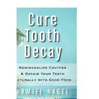 Guérir les caries, reminéraliser les cavités et réparer vos dents naturellement avec Good - Ramiel Nagel