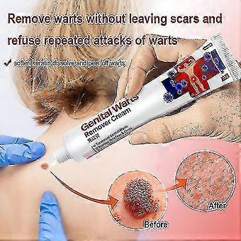 20g Removedor de verrugas Ungüento Genital Herpes Genital Tratamiento Antibacteriano Crema Nuevo