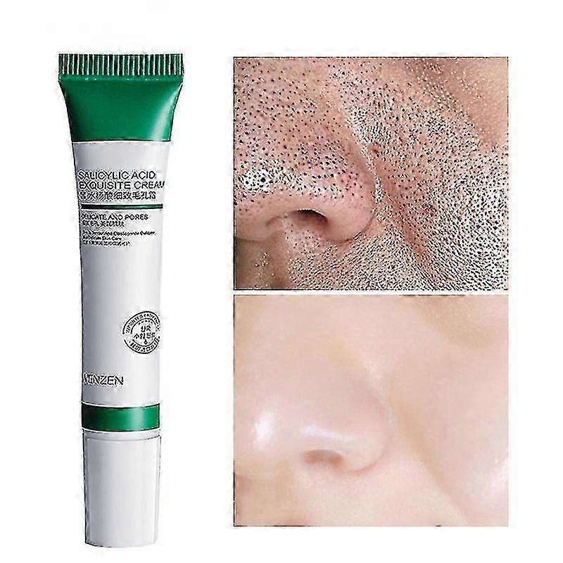 20ml salicylic οξύ πόροι που εξευγενίζουν την κρέμα συρρικνώνουν τον πόρο βελτιώνουν την ακμή Blackheads λευκαίωση κρέμα αντιγηραντική φροντίδα δέρματος ελέγχου πετρελαίου