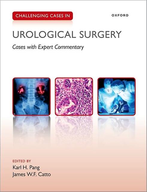 Challenging Cases In Urological Surgery Paperback