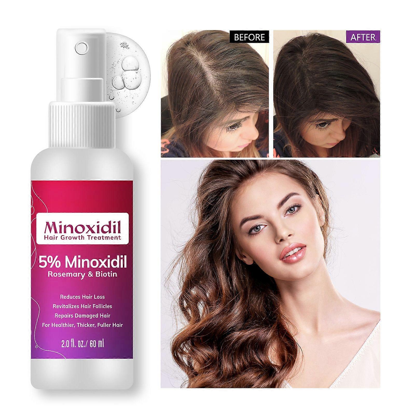 MinoxidilHårvækstbehandling, 5% MinoxidilRosmarin& Biotin 60ml