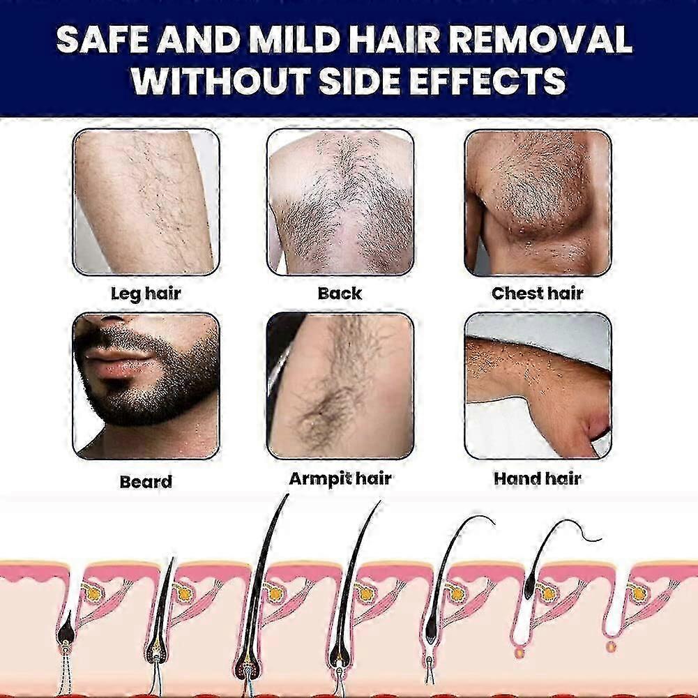 Men Permanent Hair Beard Removal Cream,depilatory Paste Face Moustache ...