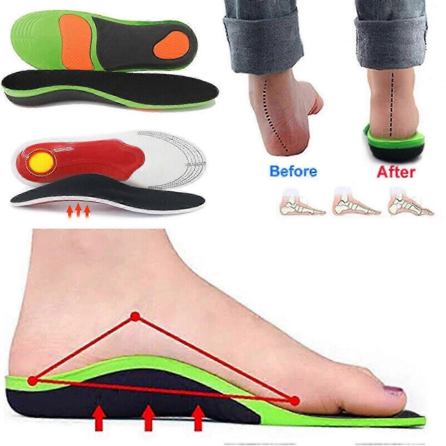 Orthopedic insoles Insert Arch Support Flatfoot Heel Pain Plantar Fasciitis