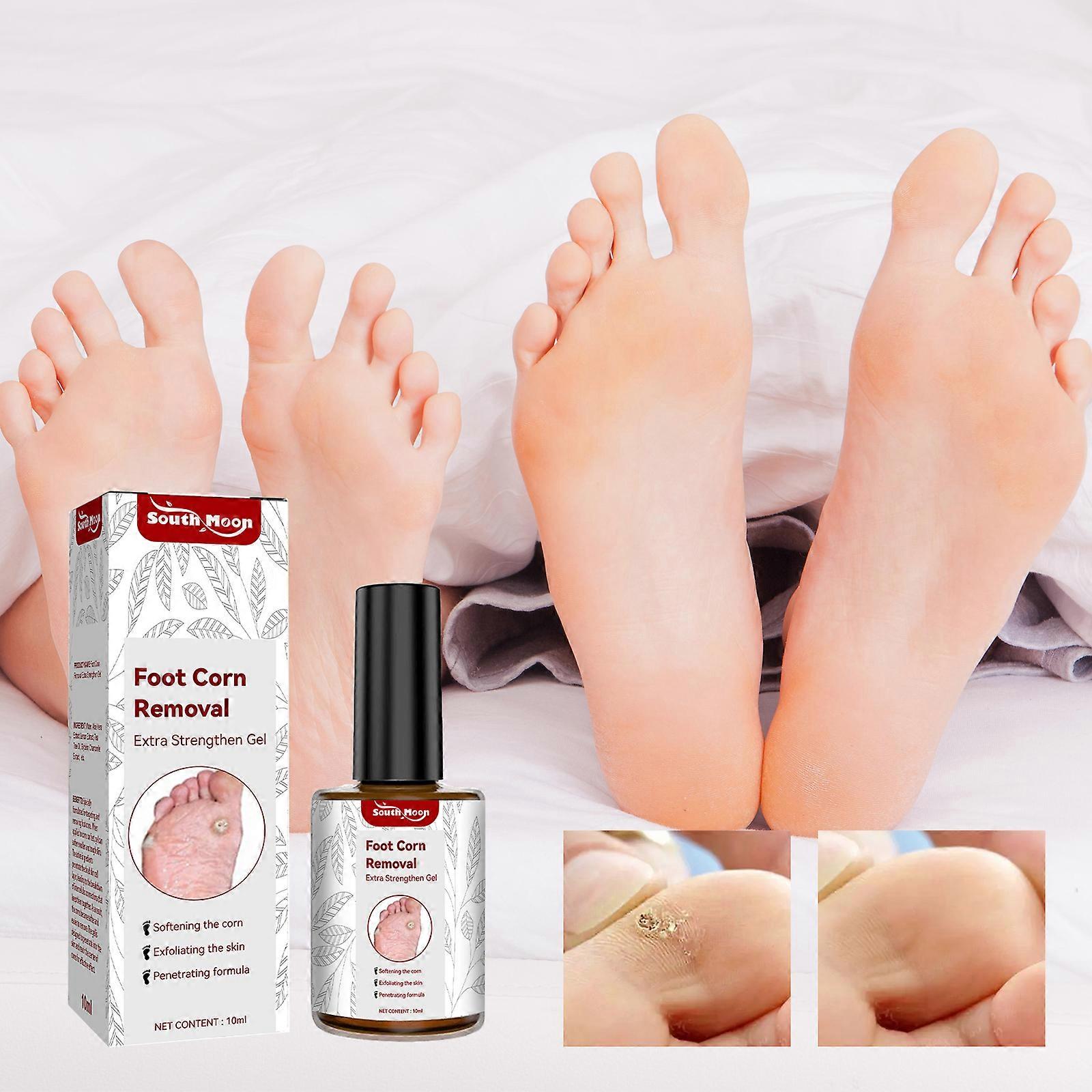 Special gel for removing corns on feet, smoothing and repairing cleansing gel for warts and calluses on hands and feet