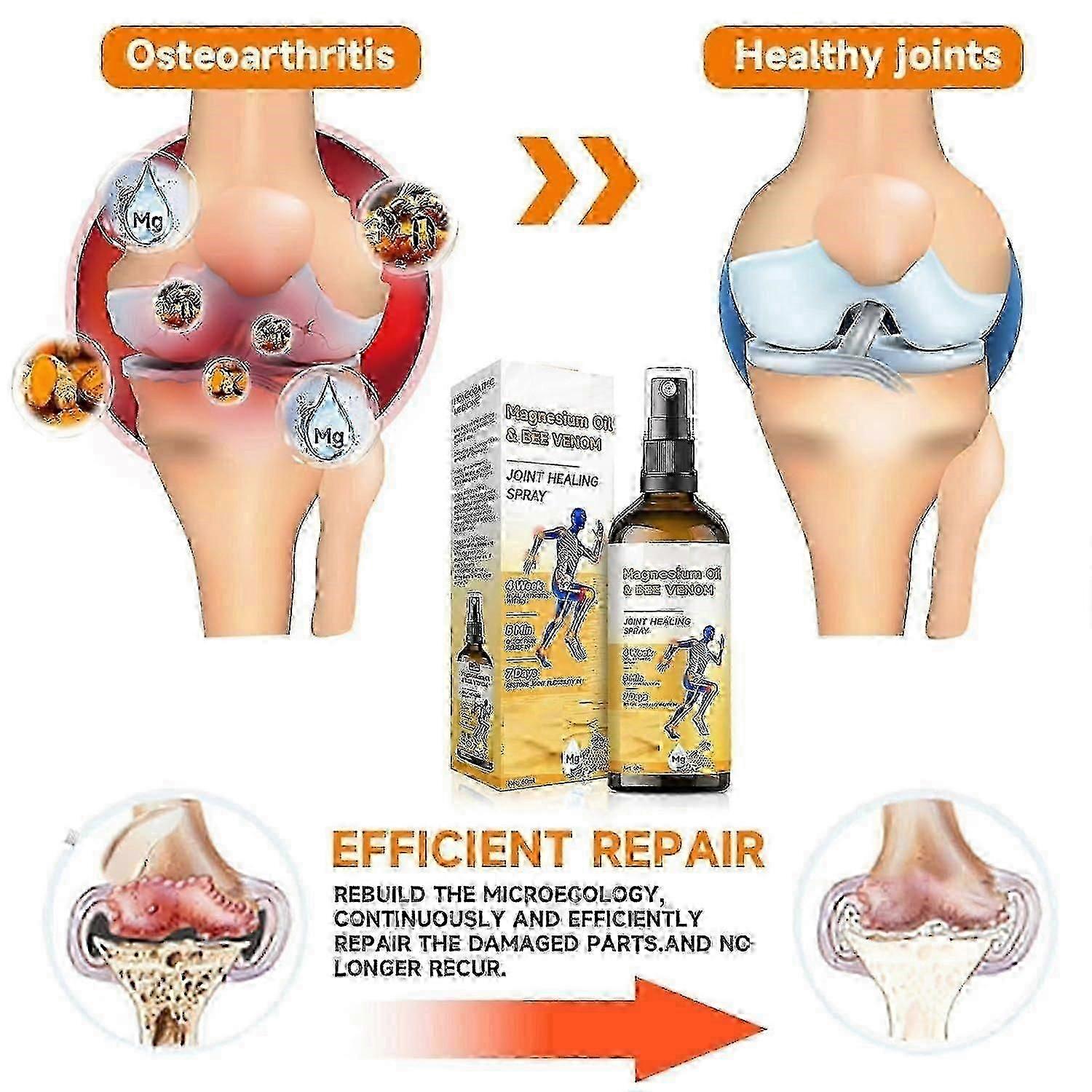 ビーヴェノムスプレー、ビーヴェノムジョイント&ボーンケアスプレー、マグネシウムオイルビーヴェノムジョイントリリーフスプレー、筋肉ジョイントの不快感のためのジョイントマッサージスプレー