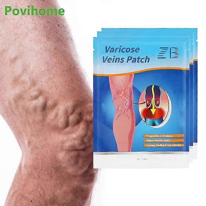 24pcs spatader behandeling patch dij flebitis vasculitis spider verwijdering St