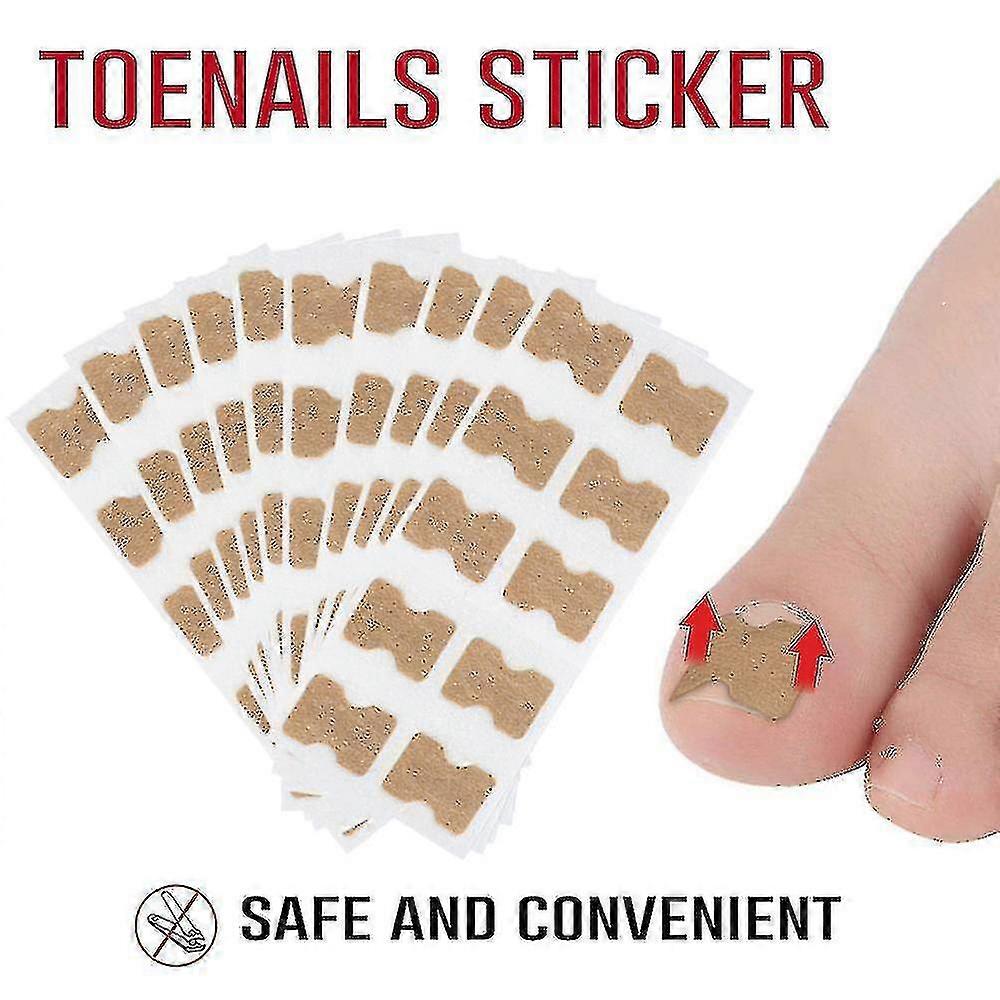 10/50pcs Toenail Correction Patch Glue Free Pedicure Tools Toe Nail Ingrown Patch