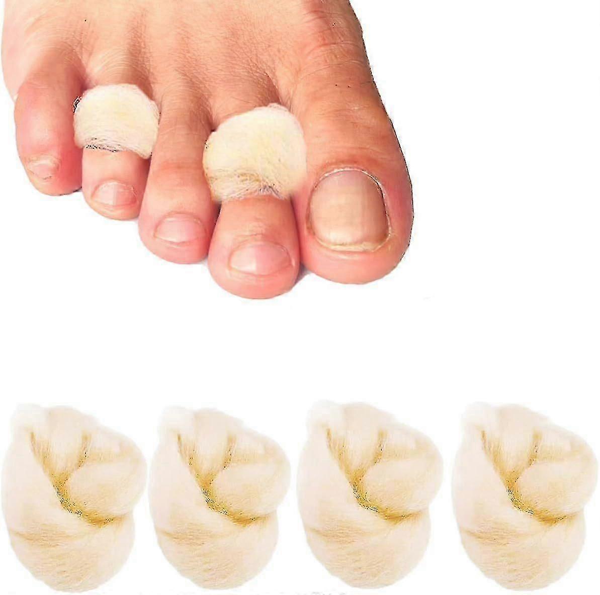 soft lambs wool toe splint cushions feet