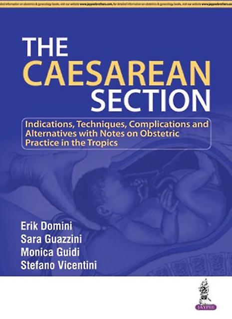 The Caesarean Section by Erik Domini Paperback Book