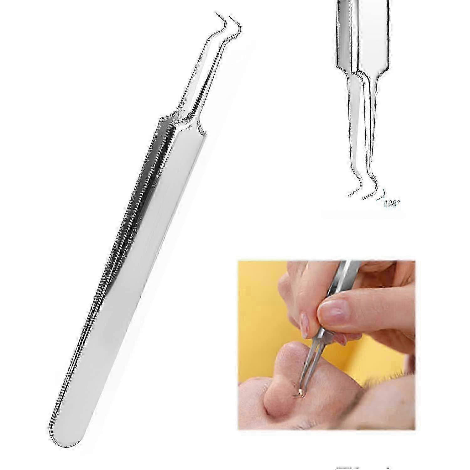 Kit de ferramentas extrator de cravos com estojo de armazenamento para cuidados com a pele profissional