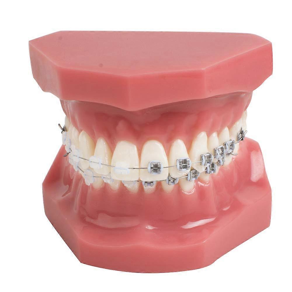 Dentální TM-208 Demonstrační ortodontický model zubů Teach studijní nástroje s kovovým a keramickým držákem (červený)