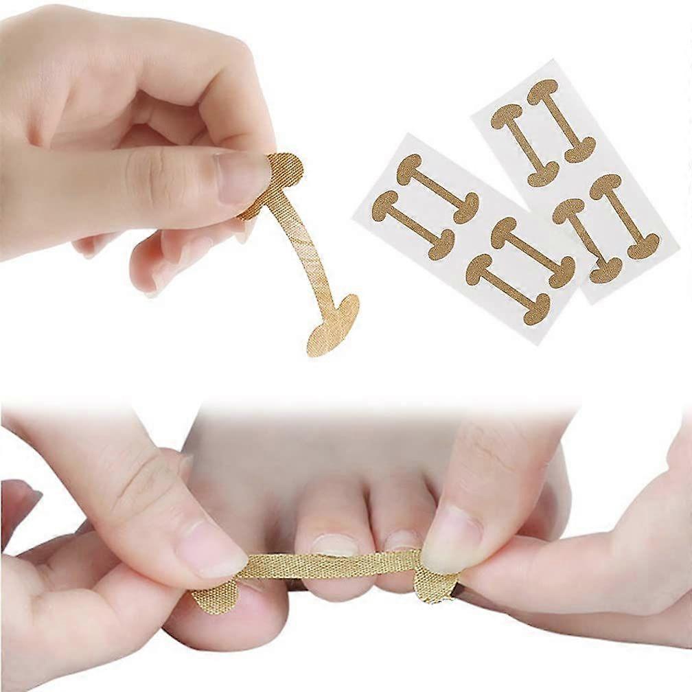 2025 Latest Model  Toenails Correction Patch, Physical Straightening Elastic