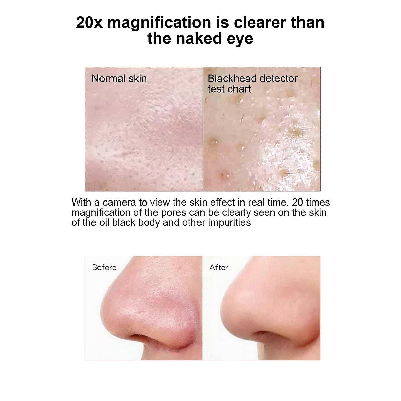 Electric Blackhead Meter to Remove Blackheads & Acne 200W Pixel 6-speed Adjustment Face Deep Cleaning with 4 Suction Heads