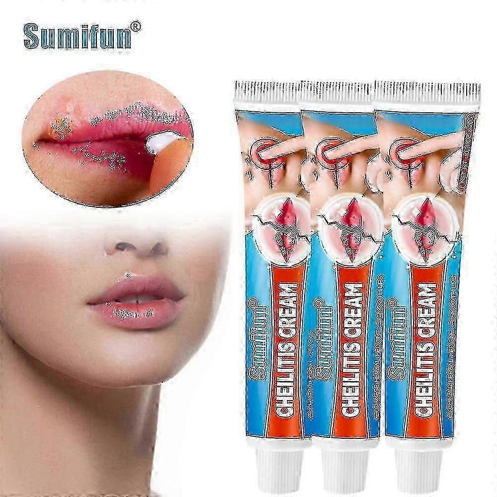 Herpes ulcerasjon behandling leppekrem