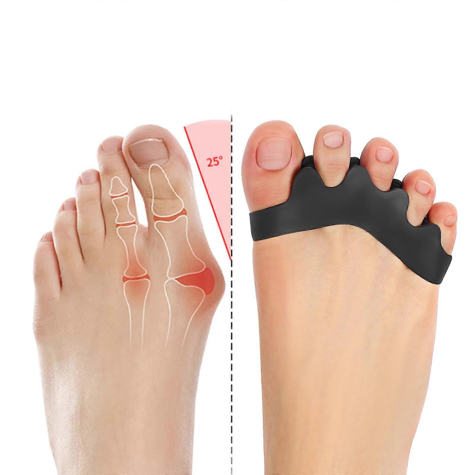 Toe Separators Gel Toe Spacers for Bunions and Overlapping Toes Flexible Alignment Support Black