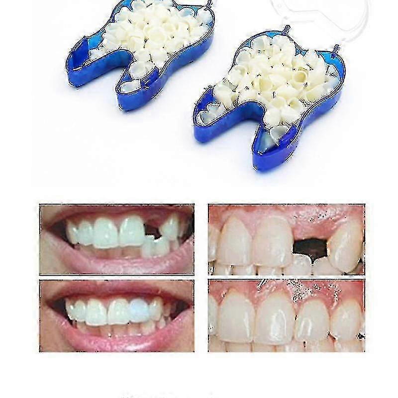 Temporary Denture Braces for Upper Missing Broken Teeth Veneer Dentures Elq