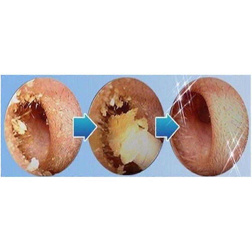 Electric Ear Cleaner for Easy and Painless Earwax Removal with Soft Spiral Tool