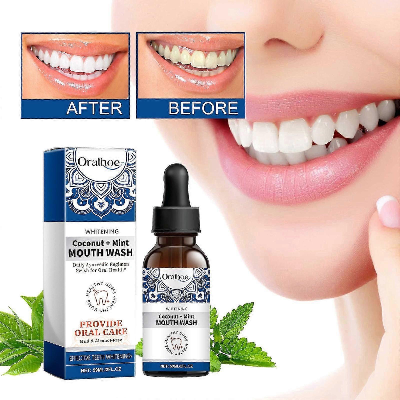 Hindistan cevizi naneli gargara, ağız gargarası, lekeleri ve kokuyu giderir, gargara, diş beyazlatma, ferah nefes, ağız bakımı, gargara