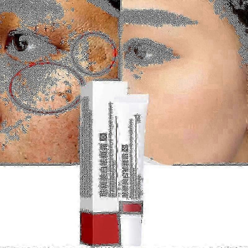 Cream To Remove Melasma And Melanin - 2023 Skin Care By Changzhao - In S And L Sizes Tw