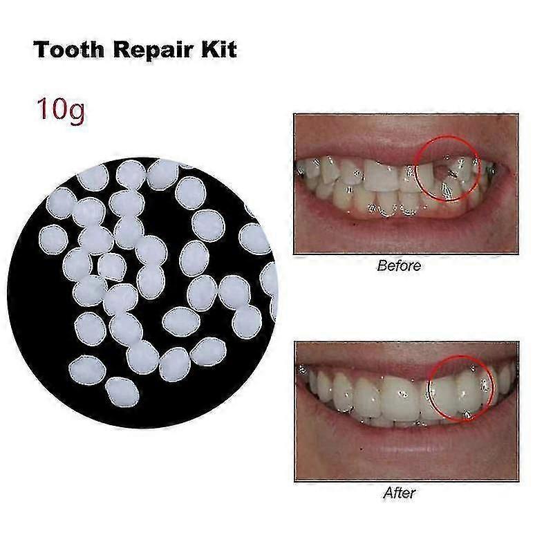 30-50g δόντι επισκευής κόλλας ρητίνης κόλλας κόλλα κόλλα συγκολλητική προσωρινή στερεωτική (εμπορικό σήμα YUYU)