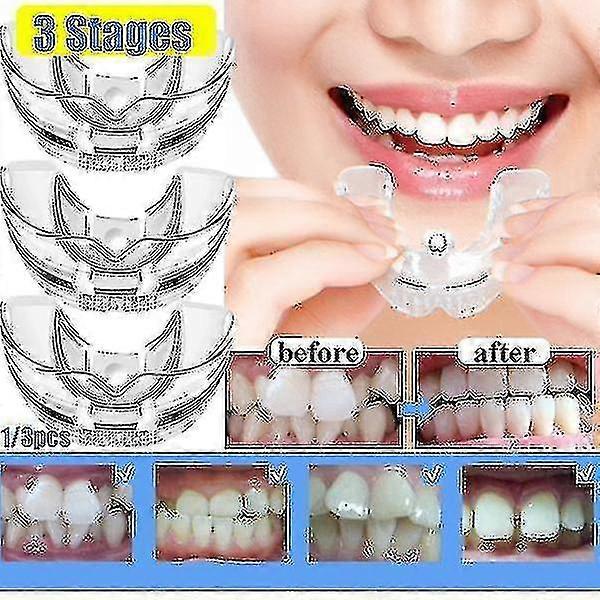 Alignment Of 3 Orthodontic Brackets, Locators, Moving Braces, And Dental Appliances