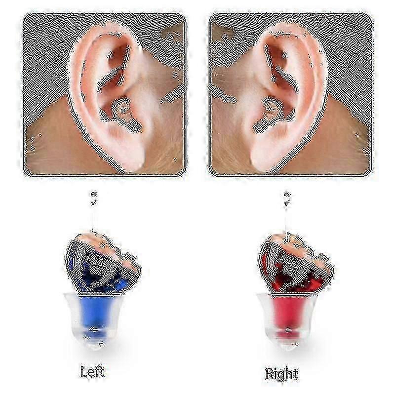 Discreet Wireless In-ear Hearing Aid – Comfortable Nearly Invisible Device For Everyday Use