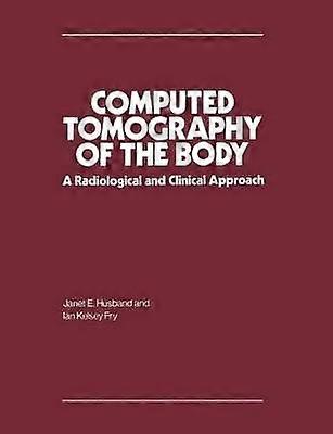 Tomografia computerizzata del corpo