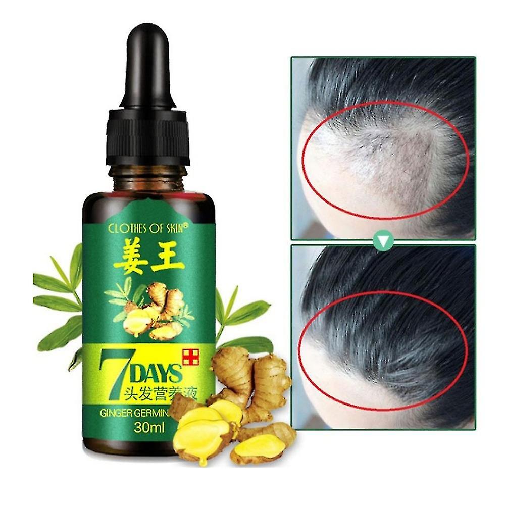 Regrow 7 Day Ginger Serum להקלה על שמן לשיער