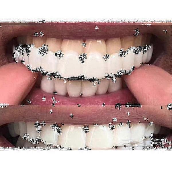 Upper/lower Comfort Fit Flex Whitening Denture Braces