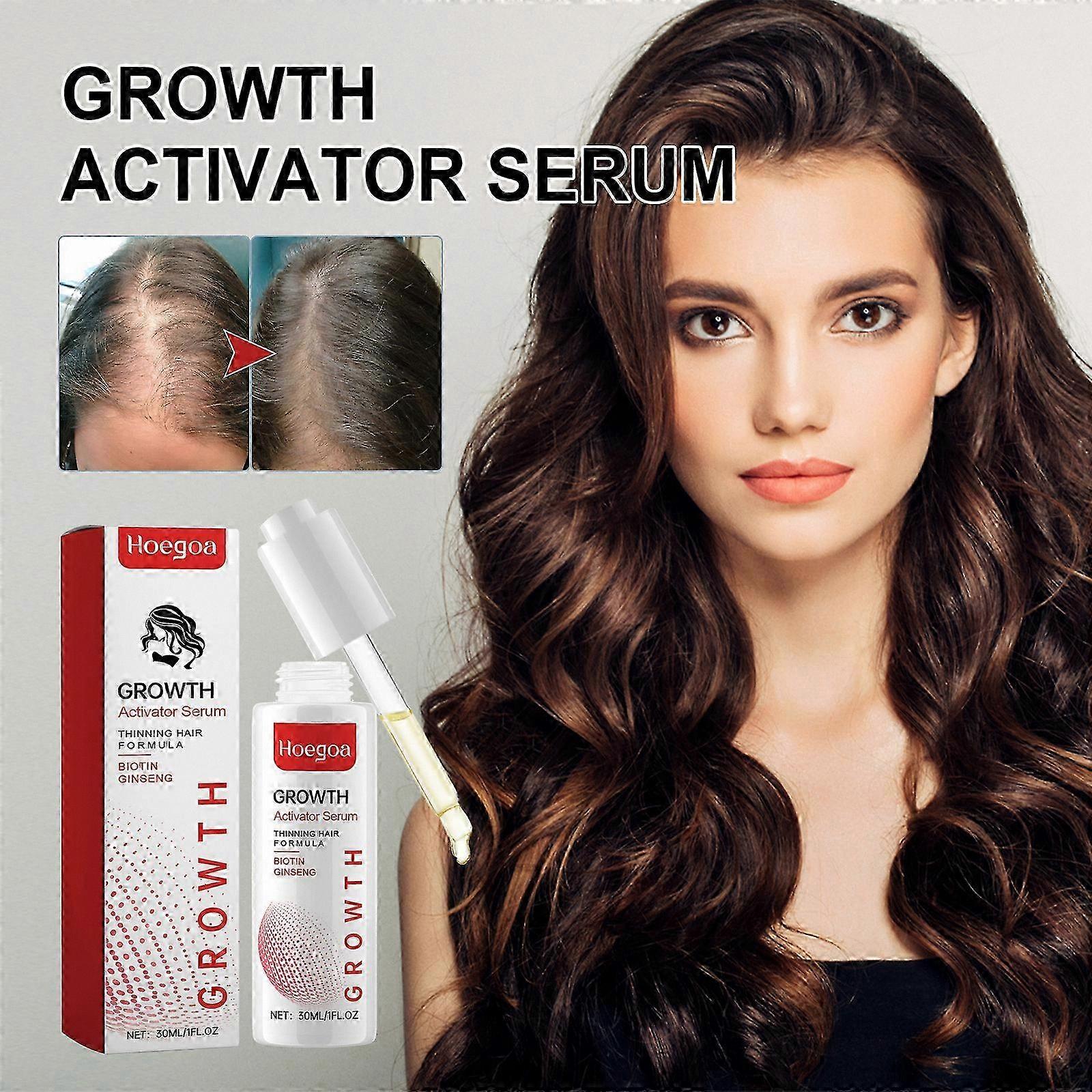 Biotin-Infused Scalp Treatment for Enhanced Hair Growth, Suitable for All Types, Promotes Hydration and Visible Thickness