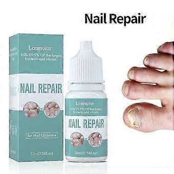 Solução de Unhas Fúngicas para Unhas dos Pés - Corrige Unhas Descoloridas, Seguro & Eficaz - Óleo Anti Fungos para Unhas Encravadas