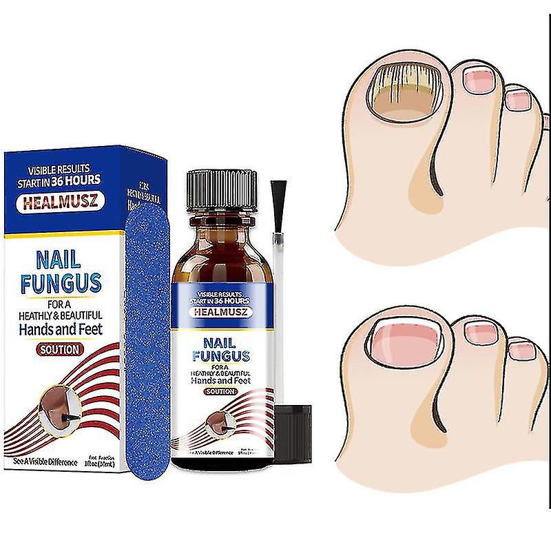 Qianfoot Nail Fungus Treatment Serum Removal Onychomycosis Paronychia