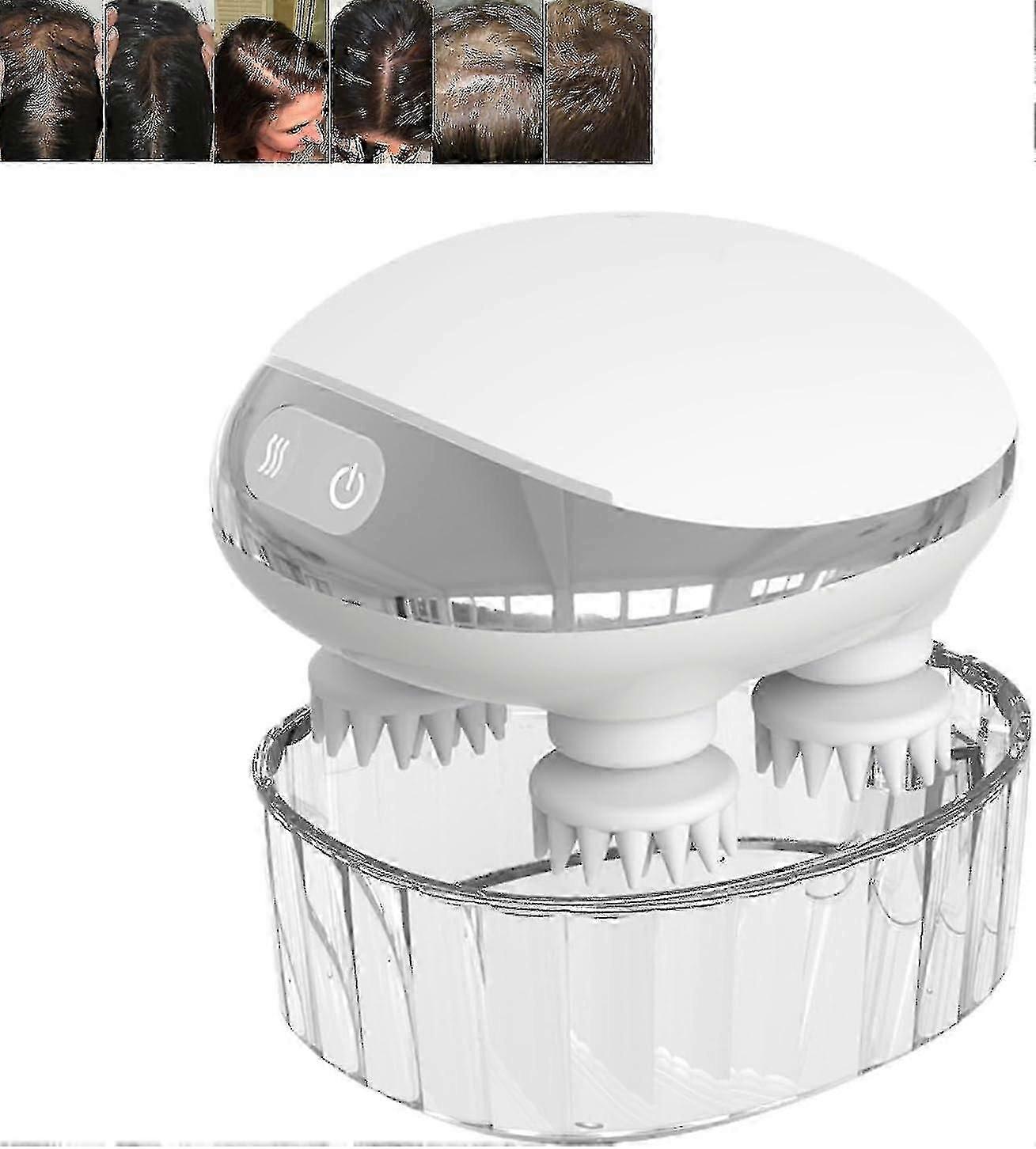 Scalphero - Masseur de cuir chevelu intelligent, Scalp Hero Massager Croissance des cheveux, avec lumière rouge -GT