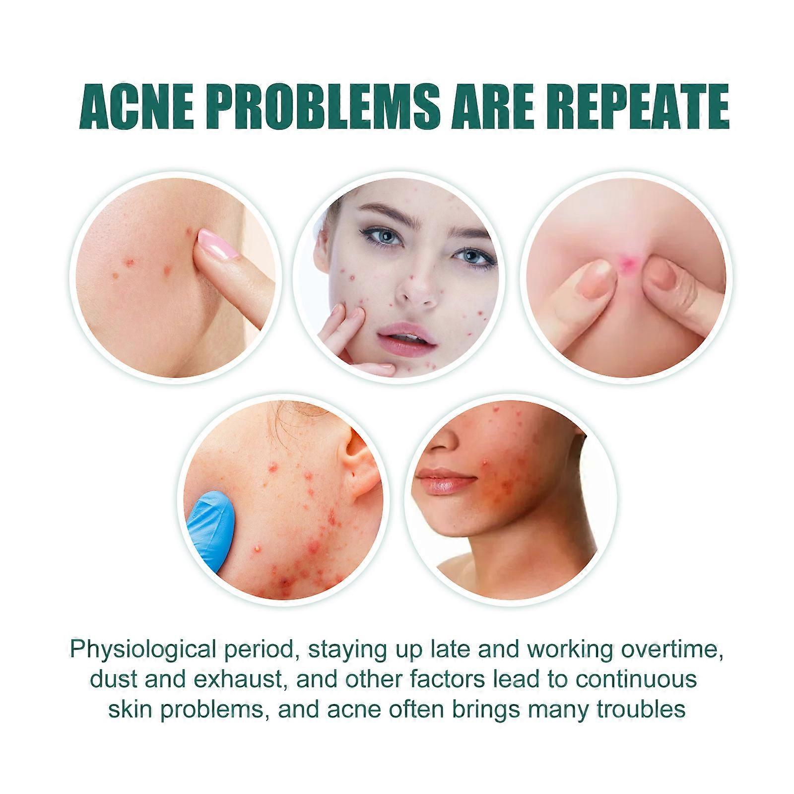 EELHOE 112 Patches Colorful Acne Patch Acne Removal Stickers Pimple Remover Tool Face Skin Care for Day Night Use