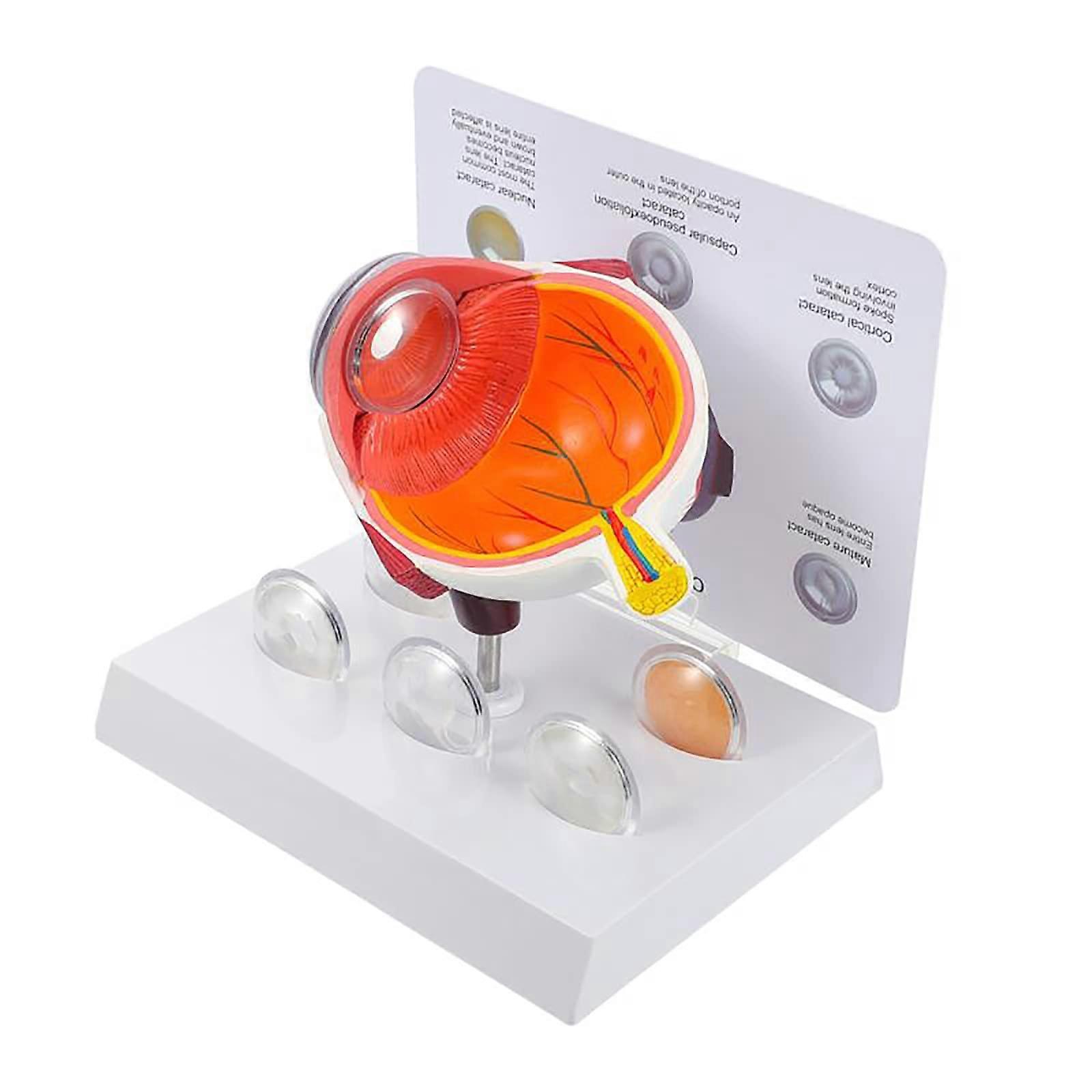 Human Eyeball Model, Model of the Anatomy of the Eye, Model of the Human Eye, Study Model Organ Model for Scientific Lessons in the Classroom