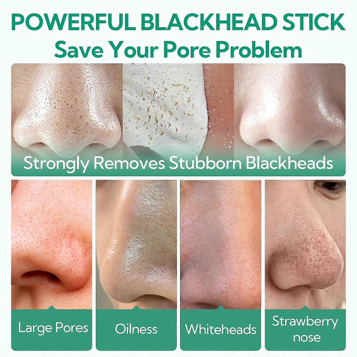 Blackhead Remover Mask, Tea Tree Oil Nose Pore Strips with 100 papers ...