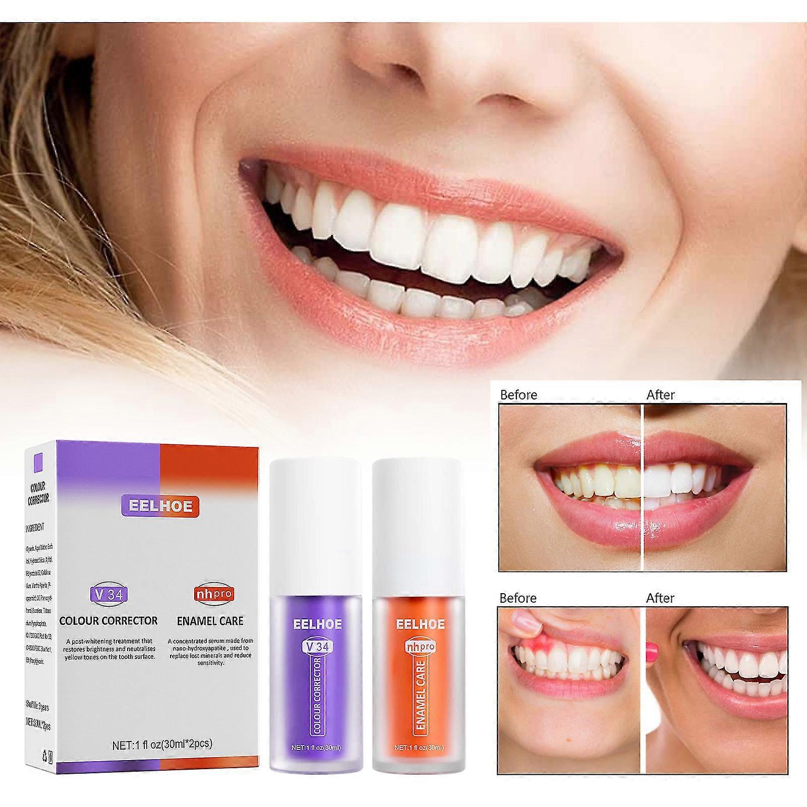 Care Toothpaste Remove Plaque Stains Sensitive Teeth Toothpaste Colour Corrector Teeth Whitening Stain Removal Ks7