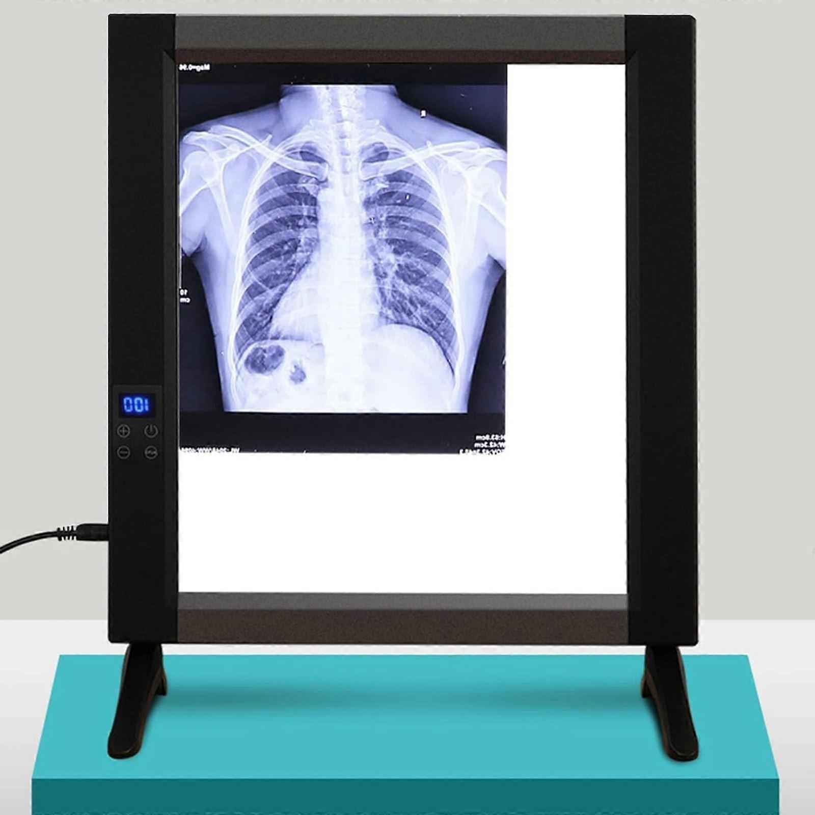 Xray view box with automatic film activation and adjustable brightness, 0– adjustable, shadow, for clinics and hospitals (50.4x47.2x2.5cm)