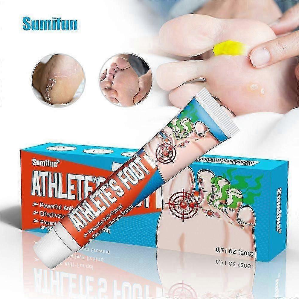 Traitement des pieds d’athlètesCrème antifongique pour la peauCrème antifongique pour un anti-démang