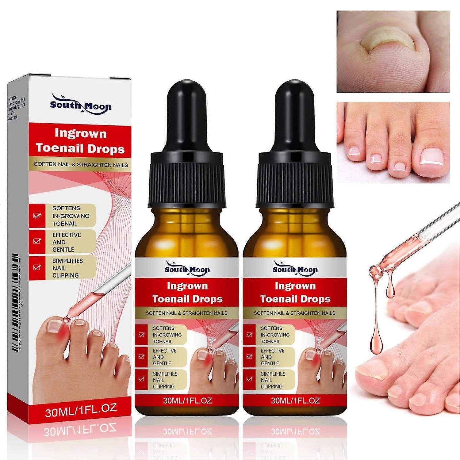 2PCS Ingrown toenail drops,Easy Trim Ingrown Toenail Tools,Toenail Fluid With Silicone Gel Toe Caps Essential Oil Diffuser,Ingrown Toenail Reliever