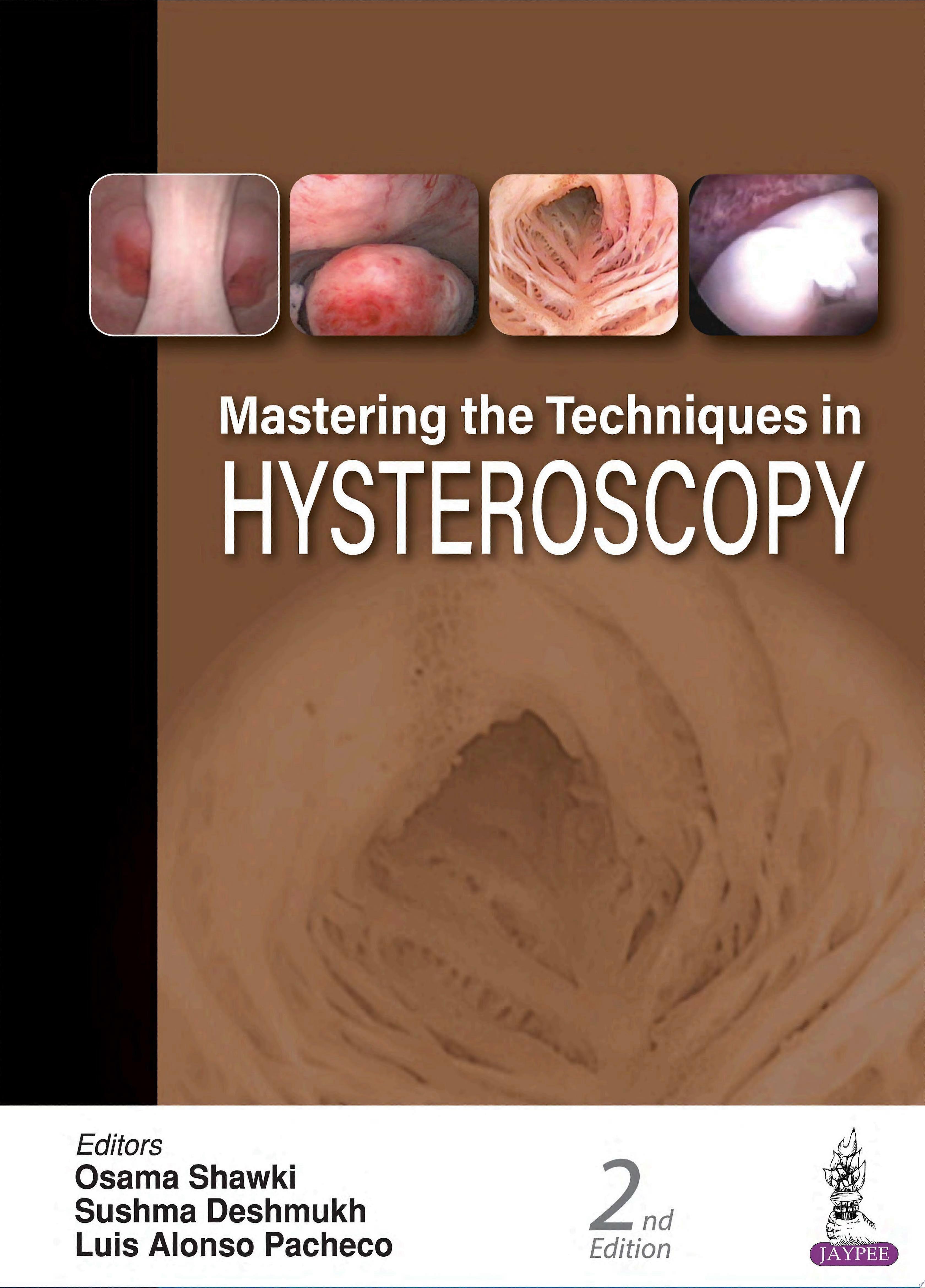 Mastering the techniques in hysteroscopy