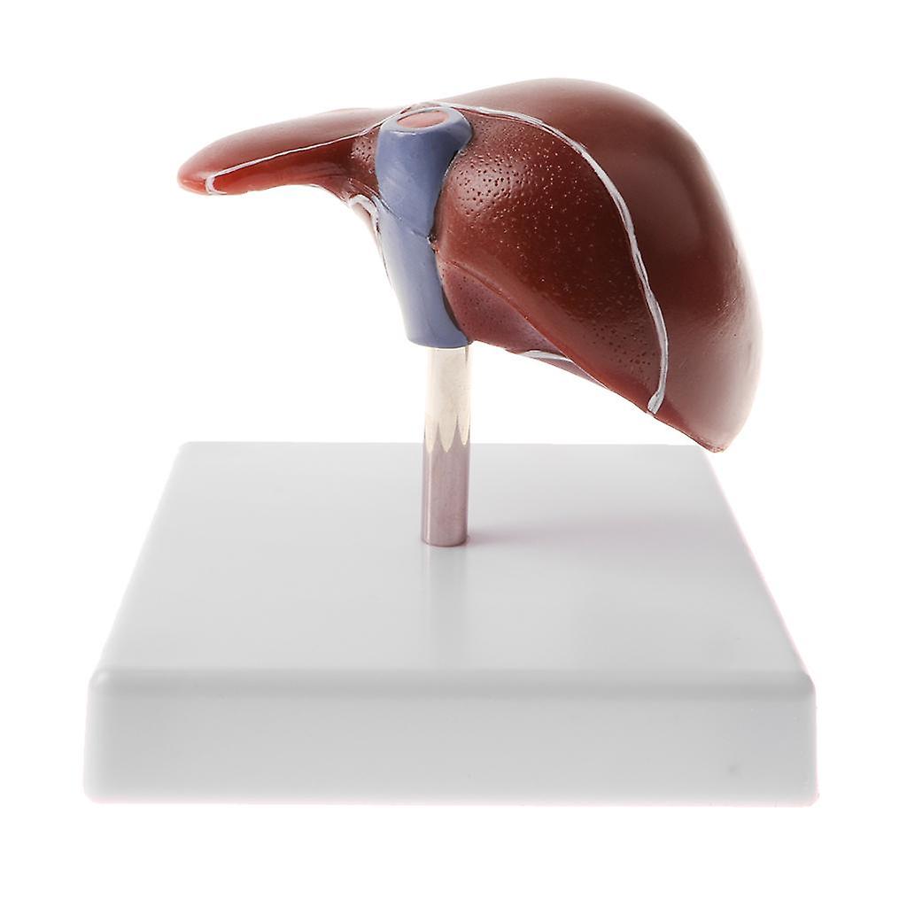 Humant sykt leverpatologisk anatomisk modell