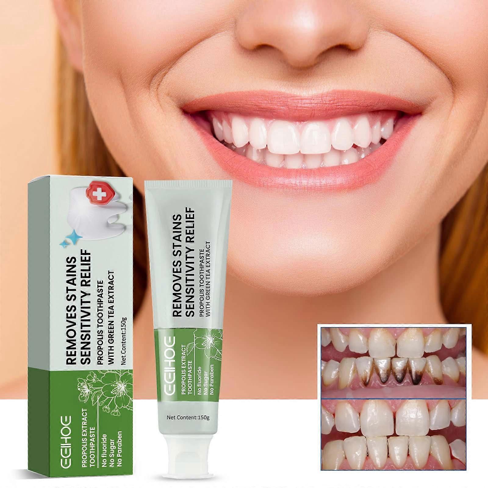 Clean Stains Fresh Breath Tooth Whitening Toothpaste 2pcs EELHOE Propolis Toothpaste