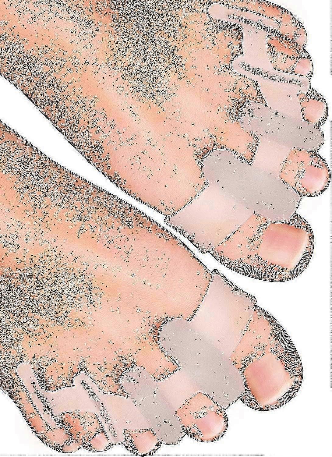 Yogamedic Toe Separator  6pcs Silicone Bunion Corrector for Relaxation