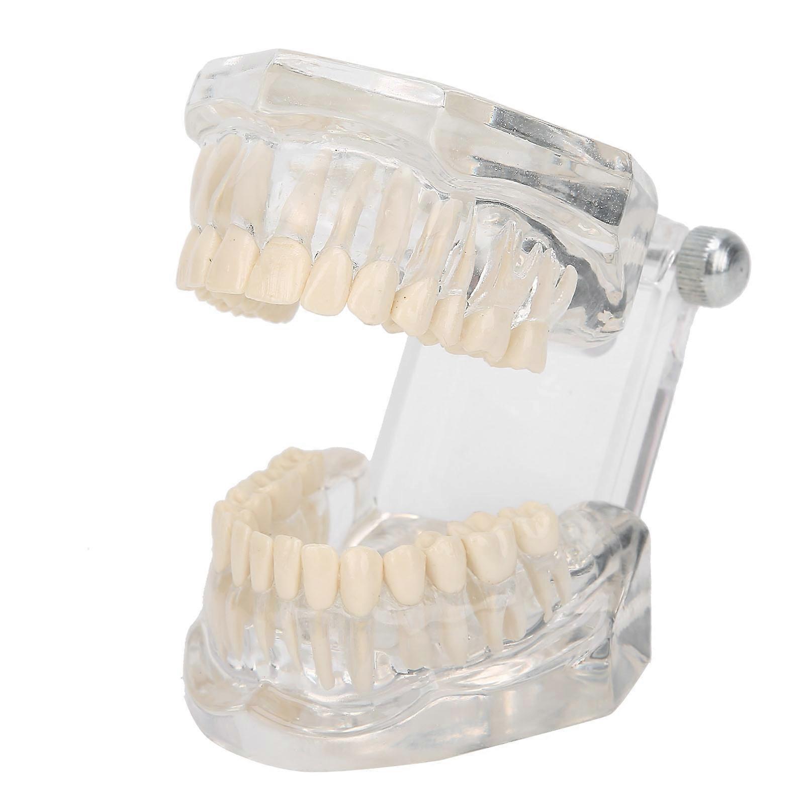 Transparent Acrylic Dental Teeth Model for Teaching Demonstration