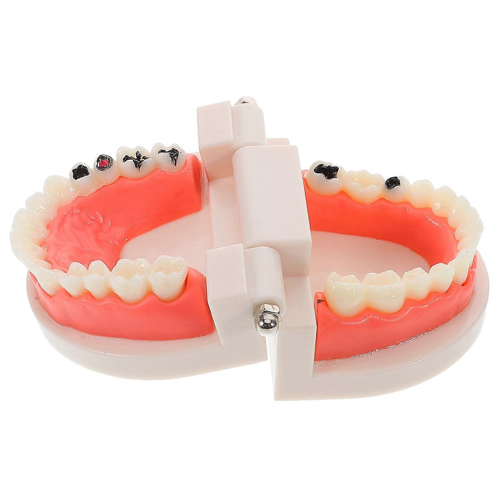 Realistic Dentist Teeth Model for Teaching Practice with Removable Design 2Pcs